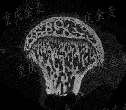 股骨头坏死模型1.jpg
