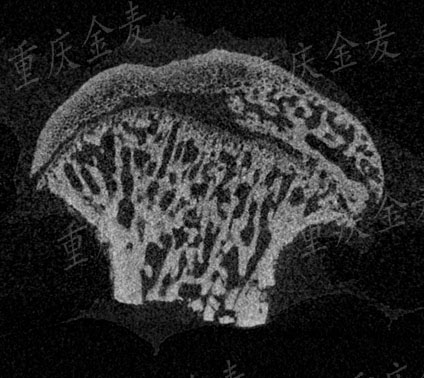 股骨头坏死模型2.jpg