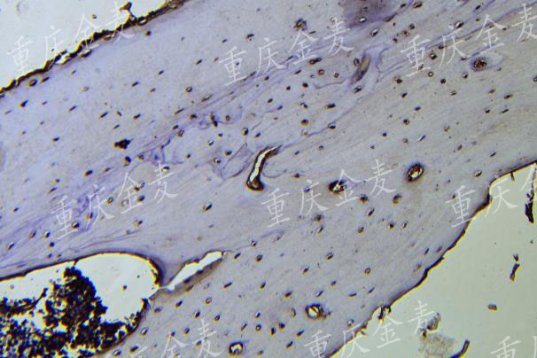 骨缺损模型1.jpg
