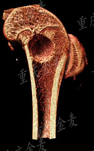 骨缺损模型3.jpg