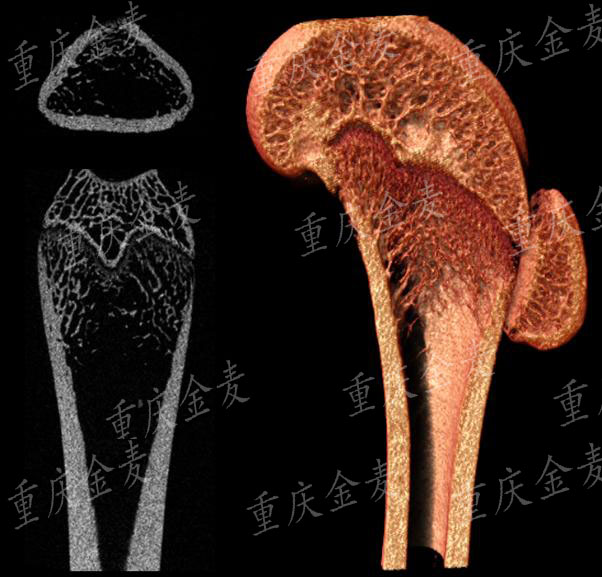 骨质疏松模型2.jpg