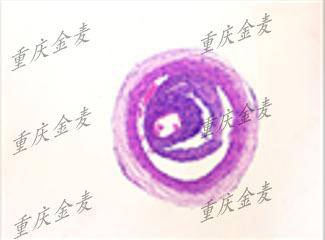 动脉粥样硬化模型2.jpg