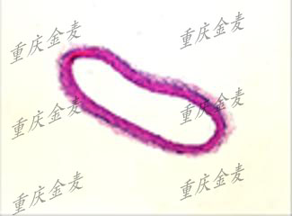 动脉粥样硬化模型